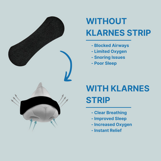 Nose Breathing Strips